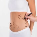 Liposuction in Jeddah