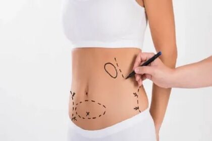 Liposuction in Jeddah