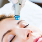 How HydraFacial Works for Your Skin