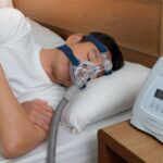 Sleep Apnea