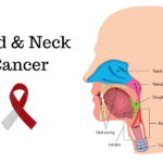 Head and Neck Cancer